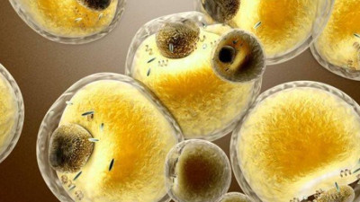 Yağ hücrelerinden bazıları kalori yakıyor