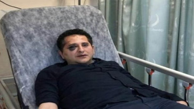 Avukat döven Cumhurbaşkanlığı korumalarına ne oldu?