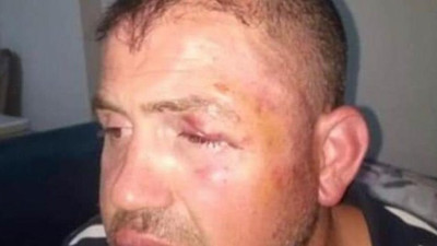 Bursa'da gaziyi hastanelik edenler tutuklandı