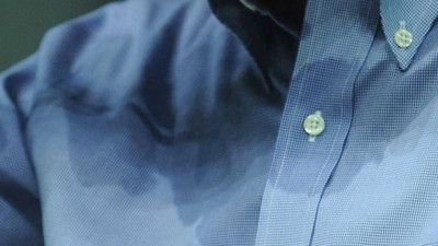 Aşırı ter sosyalleşmeyi engelliyor