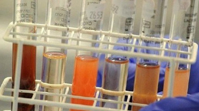 Türk bilim insanlarından meme kanserine yeni ilaç