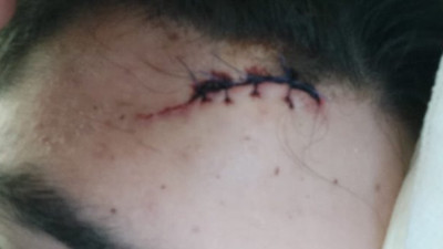 ODTÜ'lü gençlere satırlı saldırı