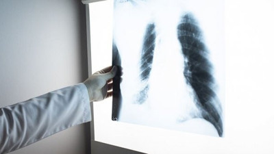 İklim değişikliği ve hava kirliliği KOAH sebebi!