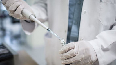 AIDS'te korkutan rakamlar! Her yıl ortalama 3-4 bin kişi