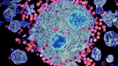 Korkutan artış: Her yıl 3-4 bin kişiye bulaşıyor