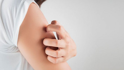 “Batı Nil Virüsü 20 farklı tür sivrisinekle bulaşabiliyor”