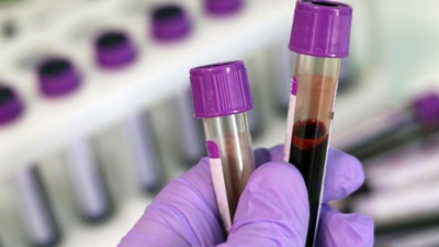 Özgür Özel açıkladı: İlaç skandalını Bakan Koca doğruladı