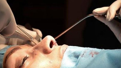 Estetikte doktor olmayanlardan uzak durun!