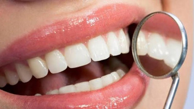 Menopoz döneminde diş kaybına dikkat