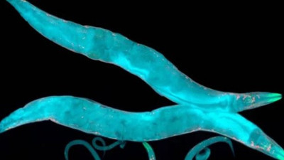 Bilim insanlarından yaşlanmayı geciktiren formül!