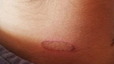 Köy okulunda skandal olay! Sıcak soba maşası ile...