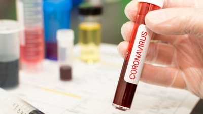 Barış Yarkadaş: Coronavirüsünü araştırmayı engellemek...