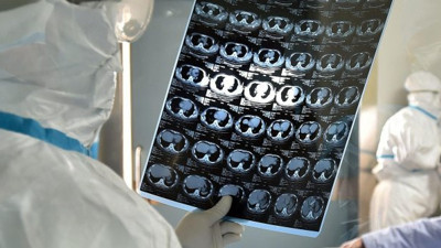 Coronavirüs gizlenmek istendi: Doktor susturuldu!