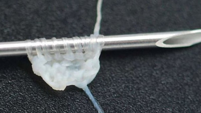 İnsan derisinden iplik geliştirildi