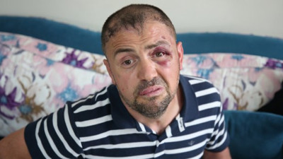 20 kişi, gaziyi darp etmişti: "Biz de mağdur olduk"