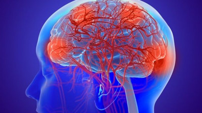 Süt ürünleri inme riskini azaltır mı?