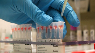 Korona virüs, o kan grubuna daha çok bulaşıyor