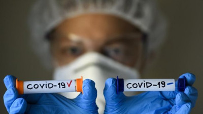 Korona virüs testi kimlere yapılacak? Ateş Kara açıkladı