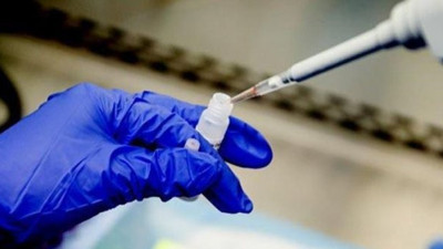 Salih Cenap Çevli: “Testi negatif çıkan Korona virüs hastaları var”