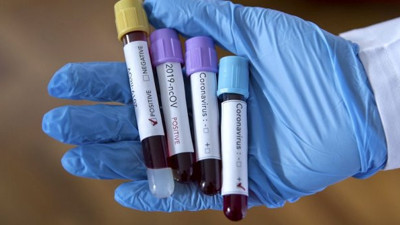 Türk bilim adamları bombayı patlattı: Bu defa güzel haber Ankara’dan geldi