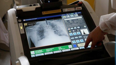 Dünya Sağlık Örgütü'nden korona virüs hakkında korkutan uyarı