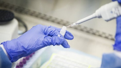 Fujifilm: "Korana ilacında sona gelindi: 50 hastada denenecek"