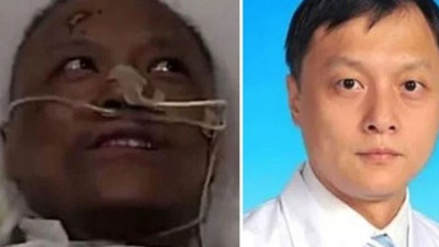 Dünya bu doktorları konuşmuştu, ten renginin neden değiştiği belli oldu