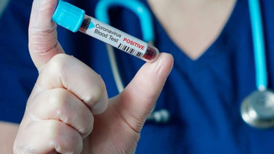 Fırsatçılar bunu da yaptı: İyileşen korona hastalarının kanları satışa çıkarıldı