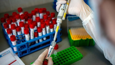 Korona virüs hastalarını 1 günde iyileştirdi; Tesadüfen fark edildi