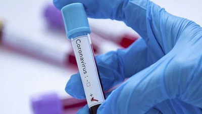 Antikor ile ilgili araştırmada kadın ve erkek konusunda ilginç detay