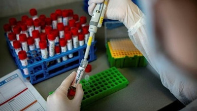 Uluslararası kuruluşlardan en son açıklama: Korona virüsün 4 yeni belirtisi var