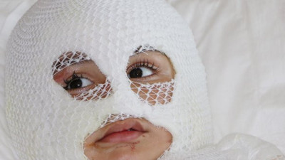 Anne- babalar bir kez daha dikkat: 10 aylık kardeşinin döktüğü çaydanlıkla yandı