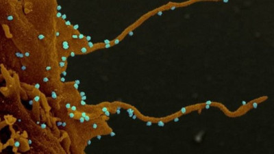 Korona virüs hakkında şok görüntüler ortaya çıktı: Kollarını açıp, diğer hücrelere saldırıyor