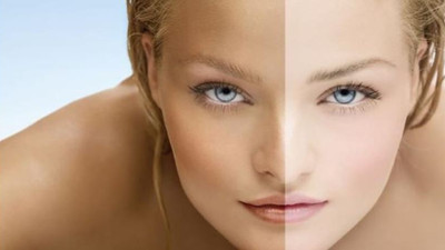 Bronzlaşayım derken cilt alevlenmesin