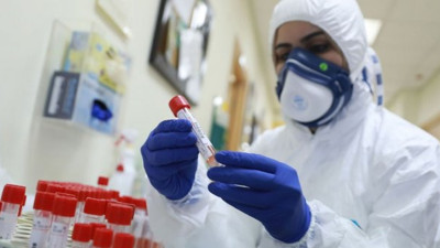 Uzmanlardan yeni uyarı: korona sonrası sendromu, bu etkiler ömür boyu sürüyor