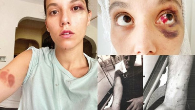 İşte Ozan Güven - Deniz Bulutsuz olayında ilk tanık ifadesi