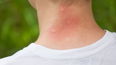 İstanbul’un kabusu oldu: Hastaneye koşan koşana