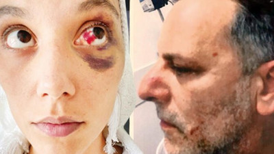 Son dakika: Ozan Güven'in Deniz Bulutsuz'u darbına dair yeni görüntüler ortaya çıktı