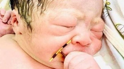 Tüm planı bozan bebek elinde o aletle doğdu