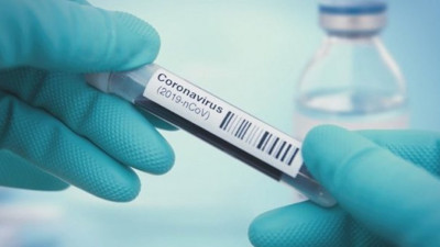 Aşıyı dün ABD bugün Rusya buldu!