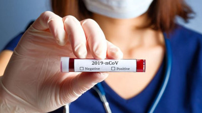 Nijerya'da bir eyalet valisinde daha Kovid-19 tespit edildi