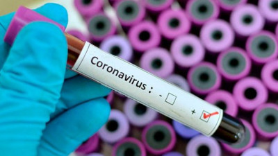 Şok iddia: 'Virüsü bana kasıtlı olarak bulaştırdılar'