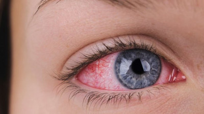 Doktorlar uyardı: 7 ve 15 yaş arasını tehdit ediyor