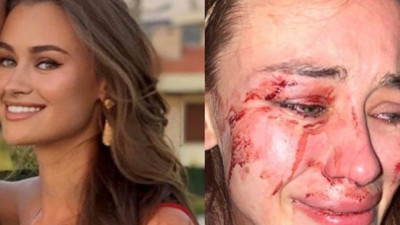 Çeşme’deki şiddeti dünyaya duyurdu! Ukraynalı top modele Çeşme'de bodyguard terörü