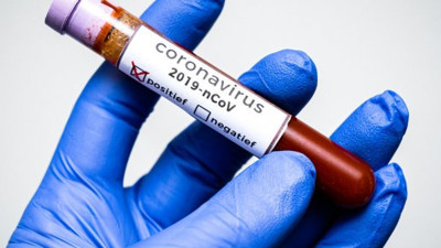 Adıyaman'da 35 ev karantinaya alındı (05 Ağustos 2020)