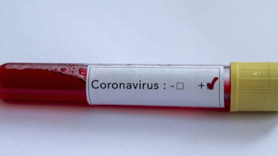 Sağlık Çalışanı gelin ve damat düğünlerinde korona oldu