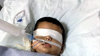 Nefes borusuna fasulye kaçtı yatalak kalacak