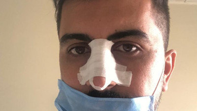 Hasta yakını, sosyal mesafe uyarısı yapan hemşirenin burnunu kırdı