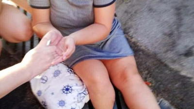 Mazgal yüzünden bacağı kırıldı