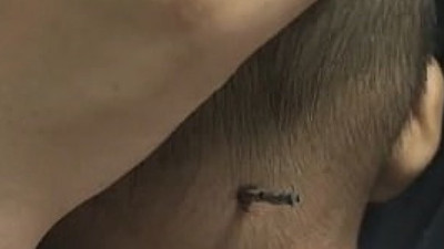 Kafasına demir çubuk ok gibi saplandı